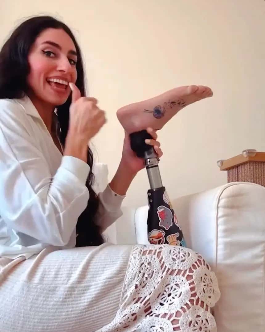 Vorschaubild von Zainab, die ihre Prothese zeigt und herumalbert