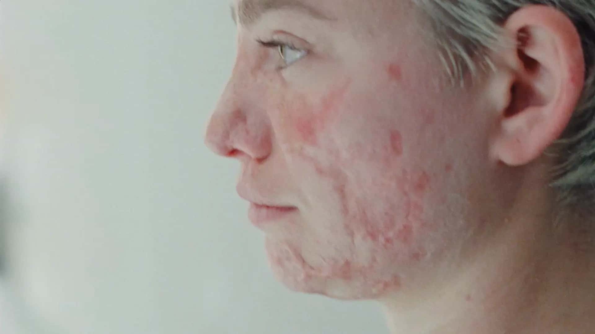 Thumbnail of closeup image of Bebe