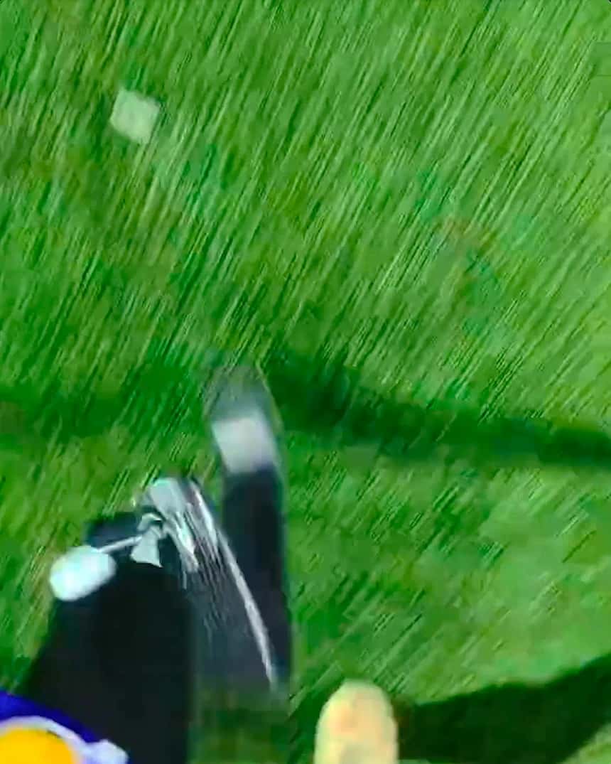 Thumbnail of Ezra's prosthetic leg while running on a grass field