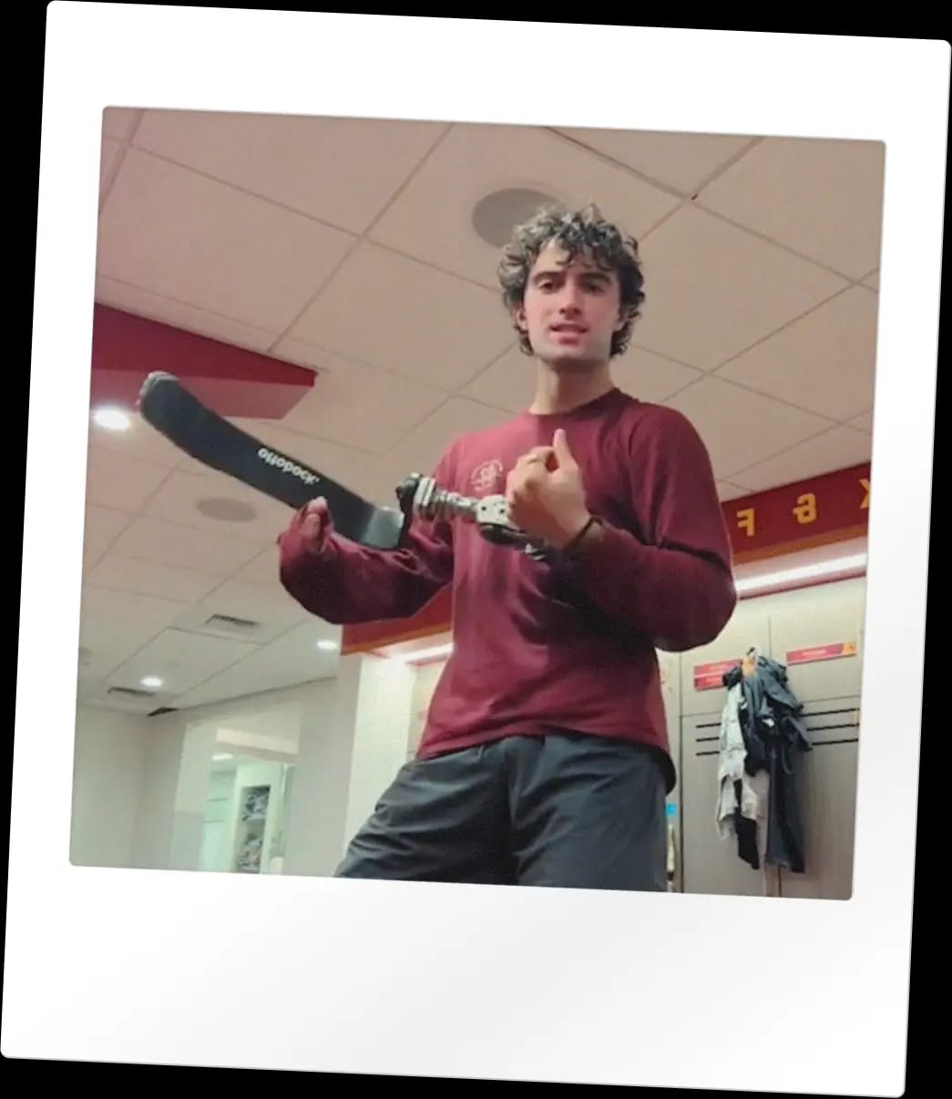 Ezra holding up his prosthetic leg